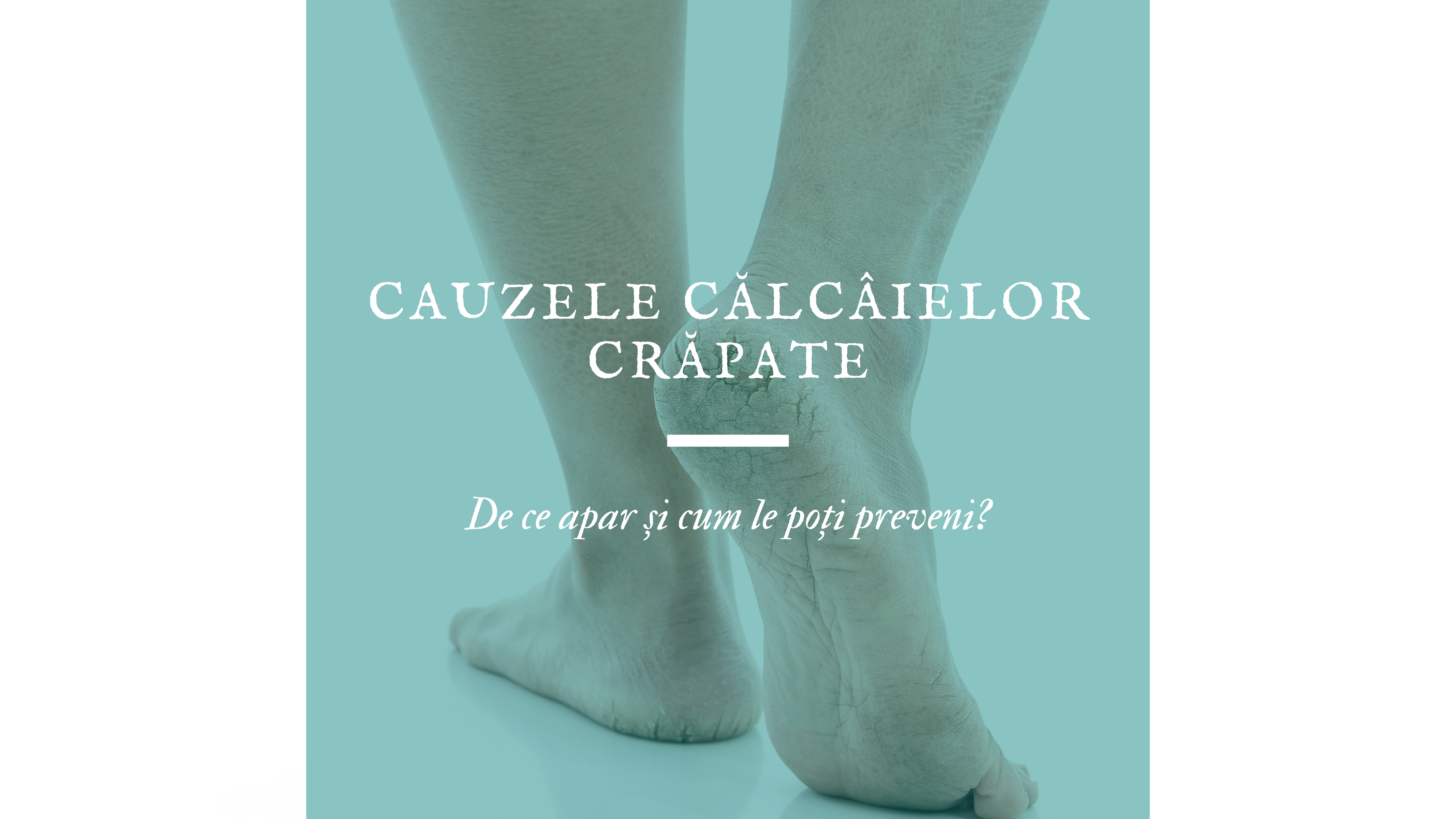 https://gehwol.ro/cauzele-calcaielor-crapate